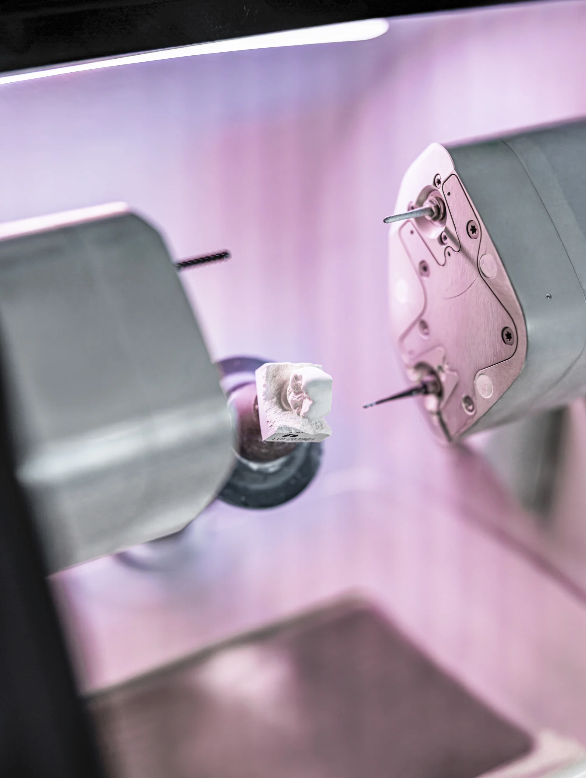 dental crowns in stouffville